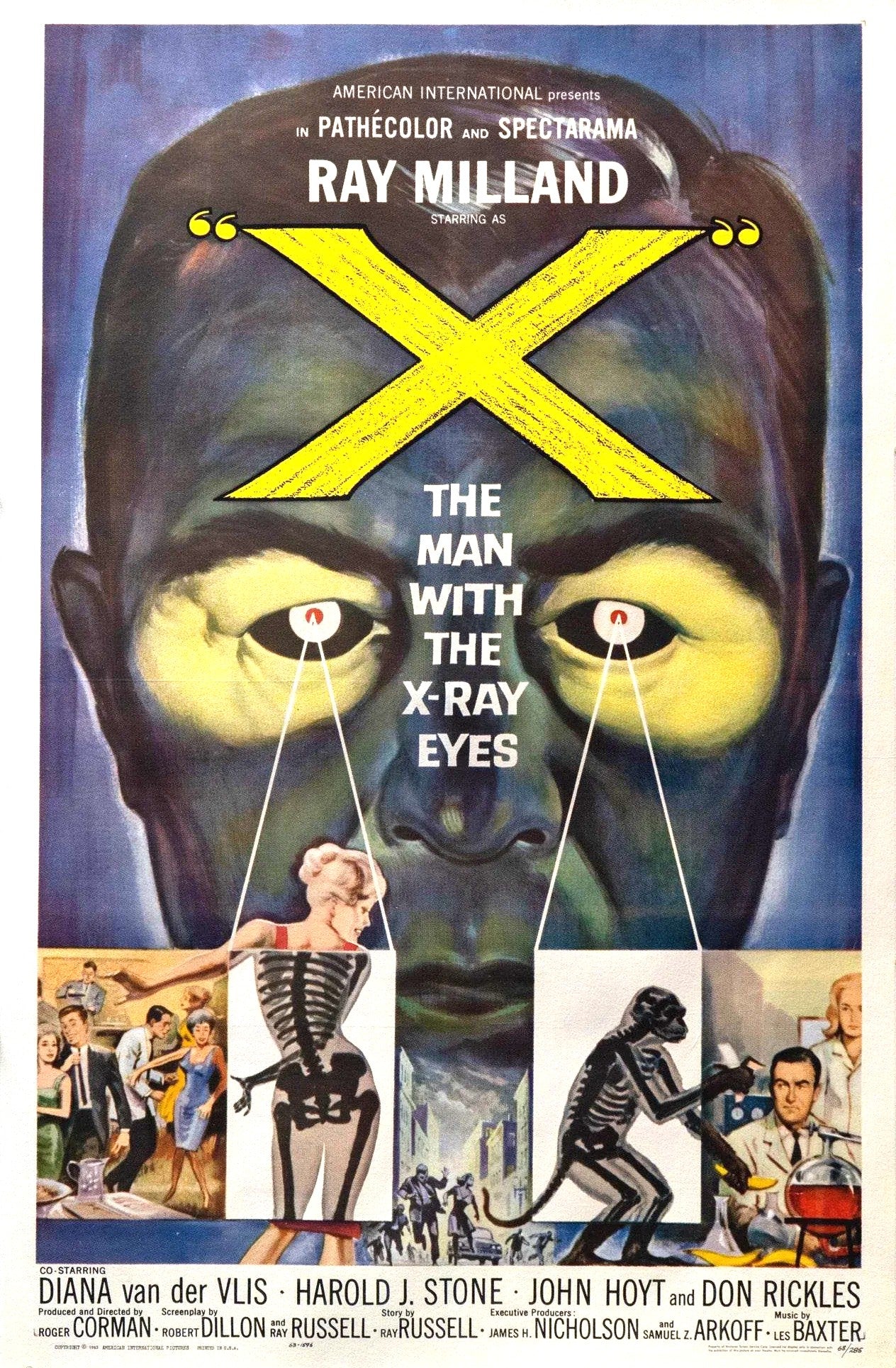 The Man with the X-Ray Eyes